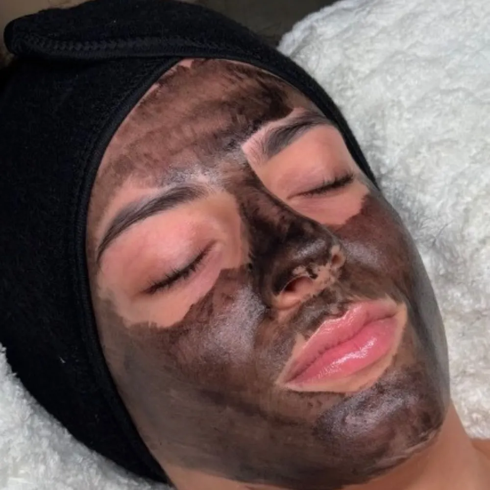 Client mid Carbon Facial treatment